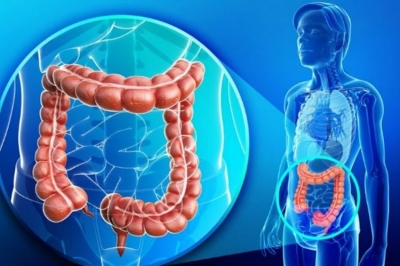 Desmitifican riesgos para desarrollar cáncer colorrectal y llaman a sumar más vida