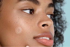 Especialistas advierten sobre riesgos de utilizar parches para acné